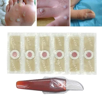 Профессиональное эффективное удаление мозолей на ногах Средство для удаления мозолей подушечками пальцев ног с